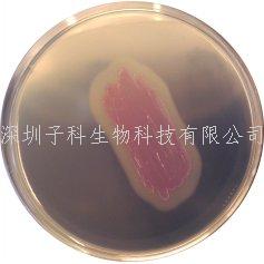 科马嘉鉴定李斯特菌显色造就基
